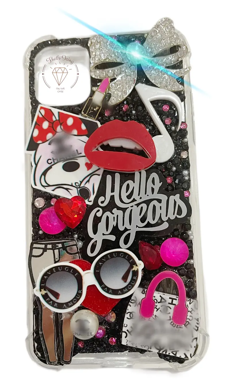 You'Re So Gorgeous Iphone 11 Case – Snap-On, Ready To Ship 1